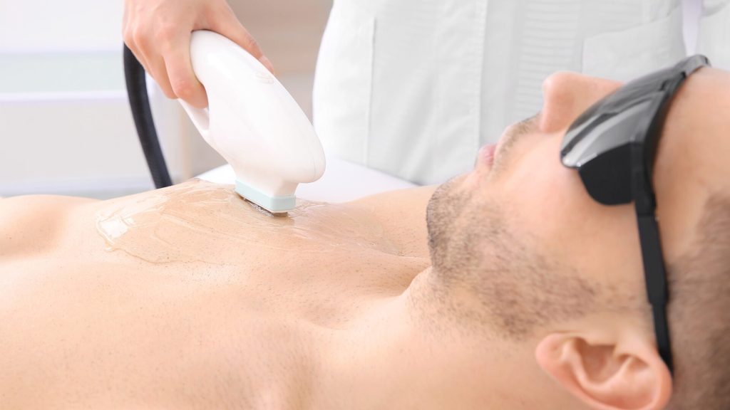Depilação a Laser em Peito de Homem