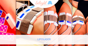 lipolaser blog