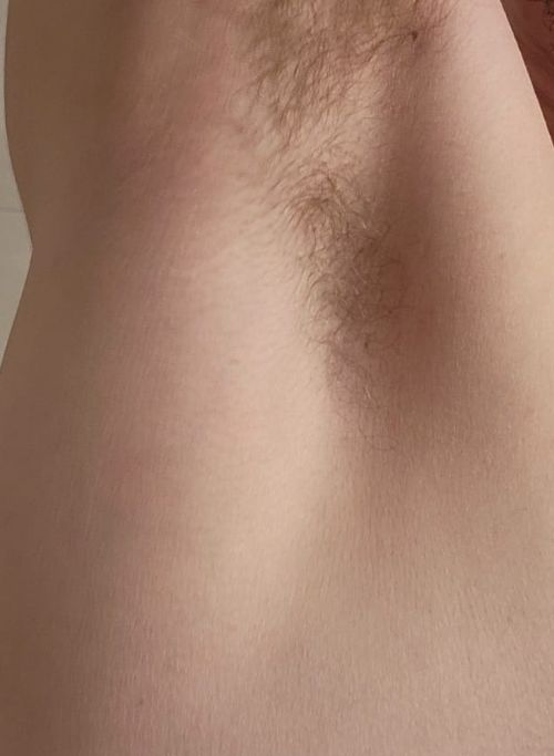 fotos depois de tirar sinais